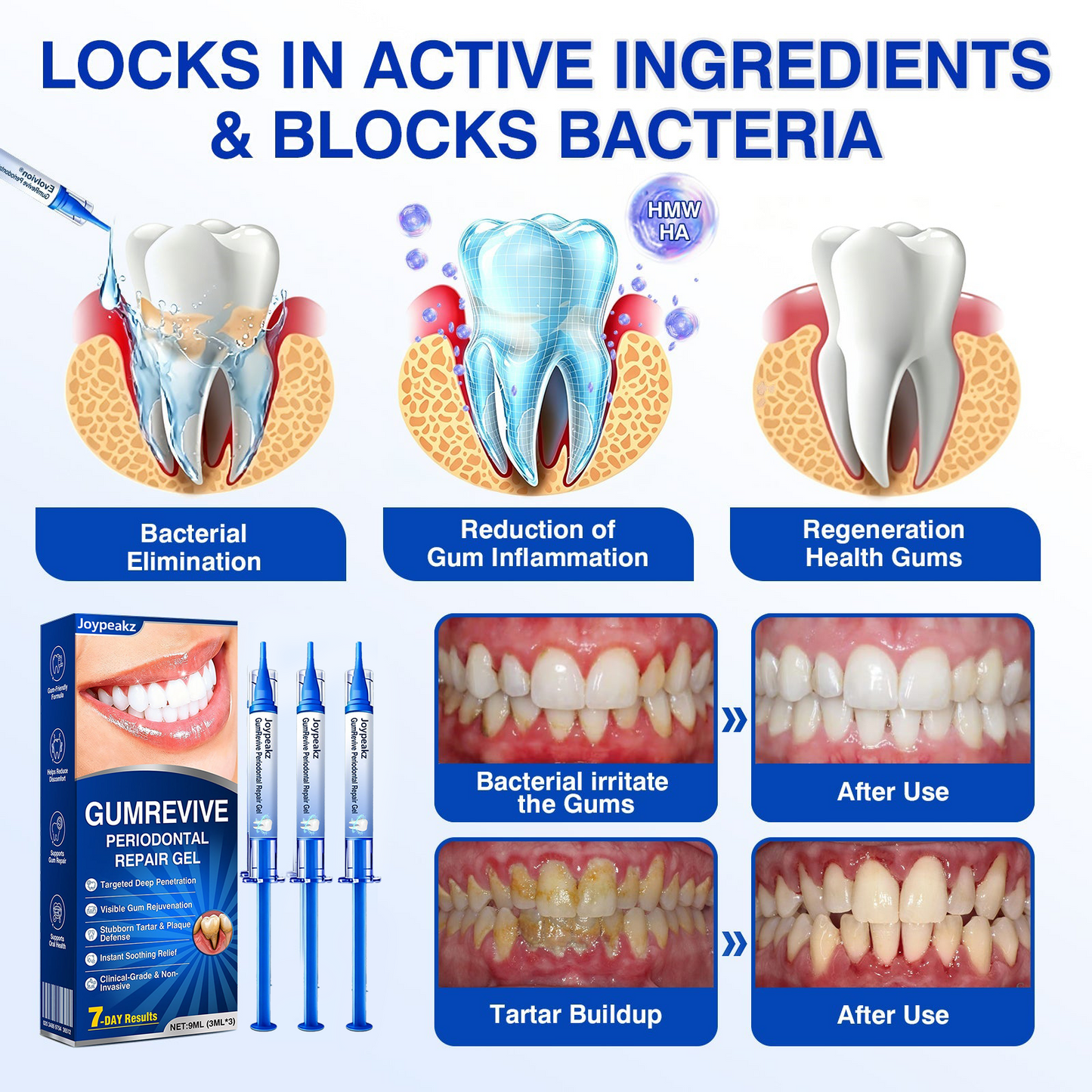 🇬🇧👨‍⚕️🦷🛡️Joypeakz® GumRevive Periodontal Repair Gel