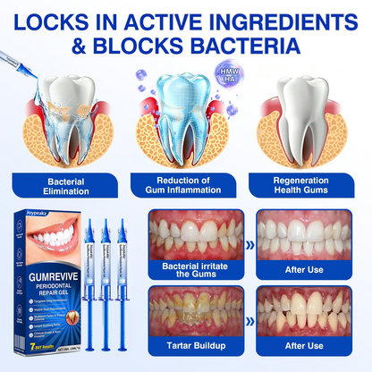 🇬🇧👨‍⚕️🦷🛡️Joypeakz® GumRevive Periodontal Repair Gel