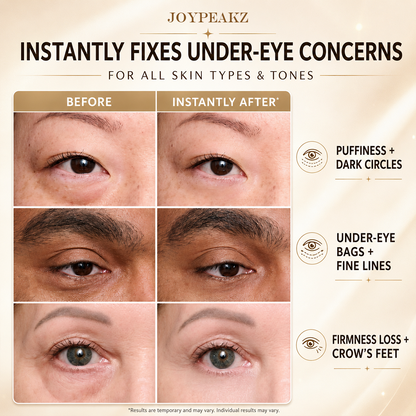 JoyPeakz™ Instant Face Temporary Tightener – Instant visible results in 60 seconds