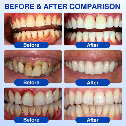 🇬🇧👨‍⚕️🦷🛡️Joypeakz® GumRevive Periodontal Repair Gel