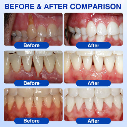 🇬🇧👨‍⚕️🦷🛡️Joypeakz® GumRevive Periodontal Repair Gel