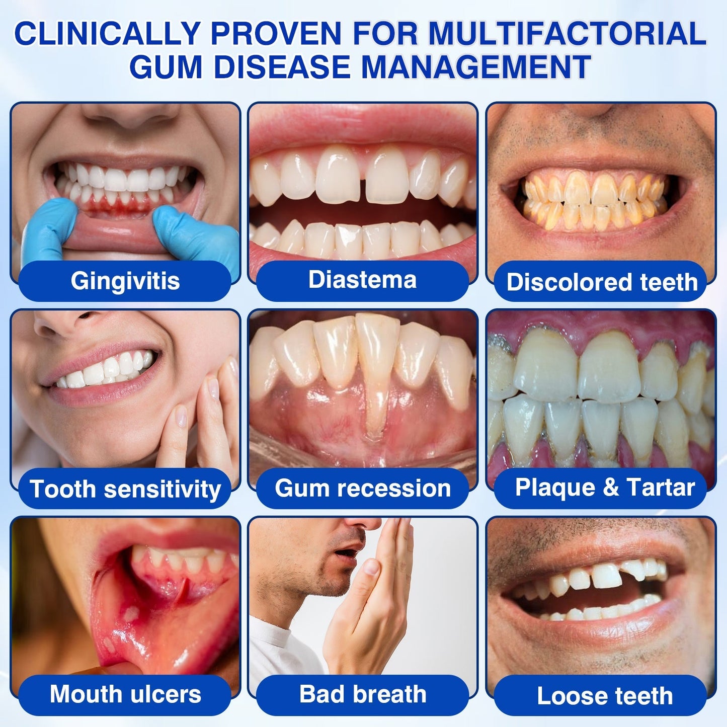 🇬🇧👨‍⚕️🦷🛡️Joypeakz® GumRevive Periodontal Repair Gel