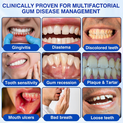 🇬🇧👨‍⚕️🦷🛡️Joypeakz® GumRevive Periodontal Repair Gel