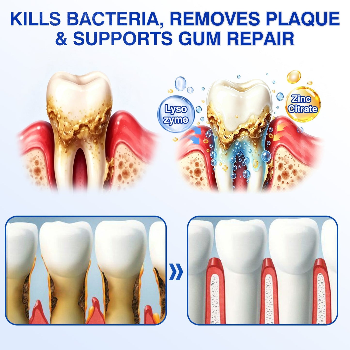 🇬🇧👨‍⚕️🦷🛡️Joypeakz® GumRevive Periodontal Repair Gel