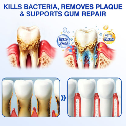 🇬🇧👨‍⚕️🦷🛡️Joypeakz® GumRevive Periodontal Repair Gel