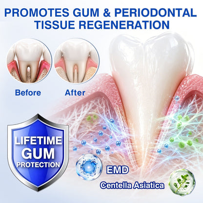 🇬🇧👨‍⚕️🦷🛡️Joypeakz® GumRevive Periodontal Repair Gel