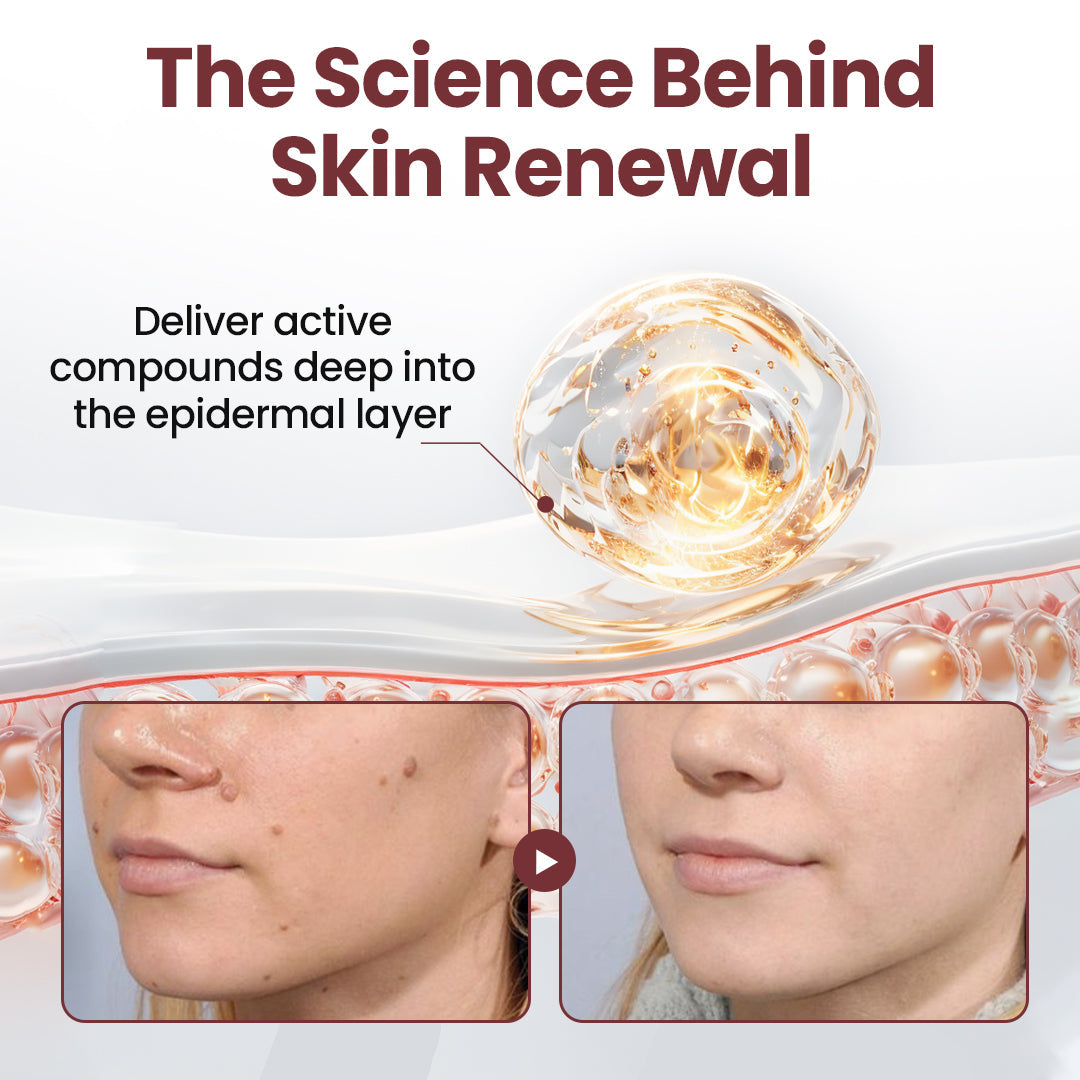 BBOJI® KeraErase Dual-Action Renewal Cream