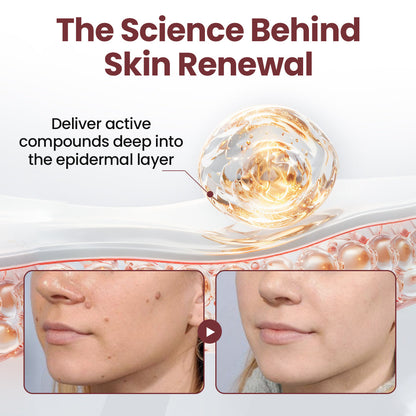 BBOJI® KeraErase Dual-Action Renewal Cream