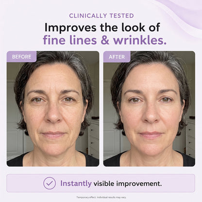 💖Reveal a Firmer, More Refreshed Look – JoyPeakz™ Face Tightener