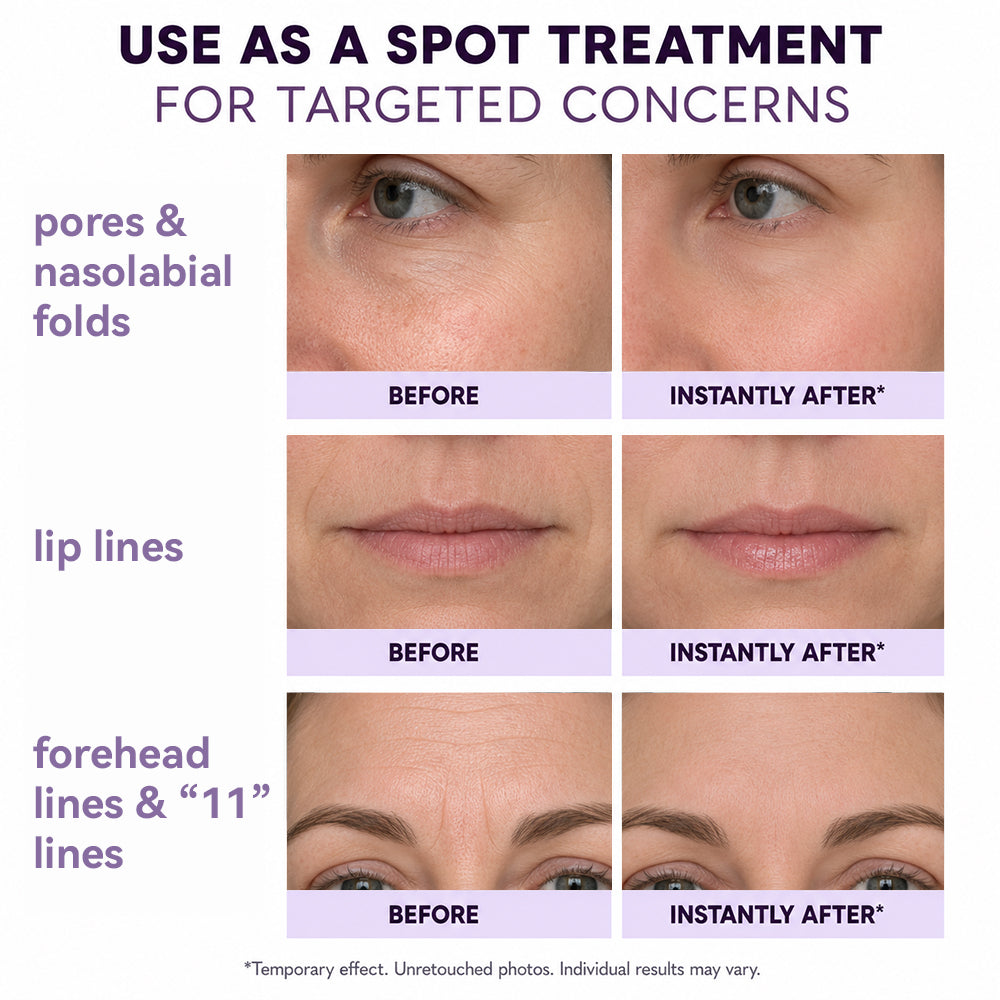 💖Reveal a Firmer, More Refreshed Look – JoyPeakz™ Face Tightener