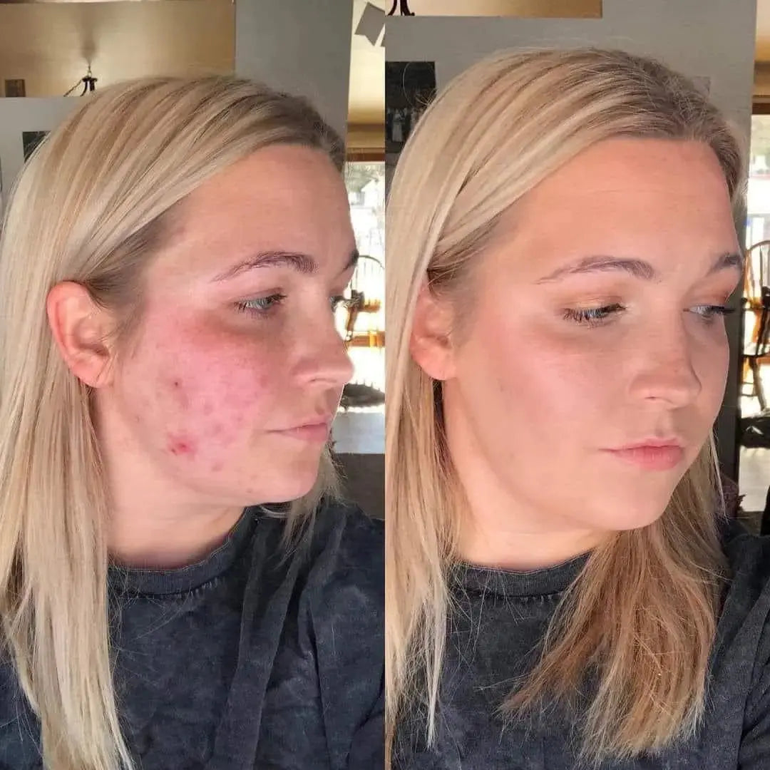 JoyPeakz™ Magic Skin Changing Foundation – Smart Shade-Adapting Makeup