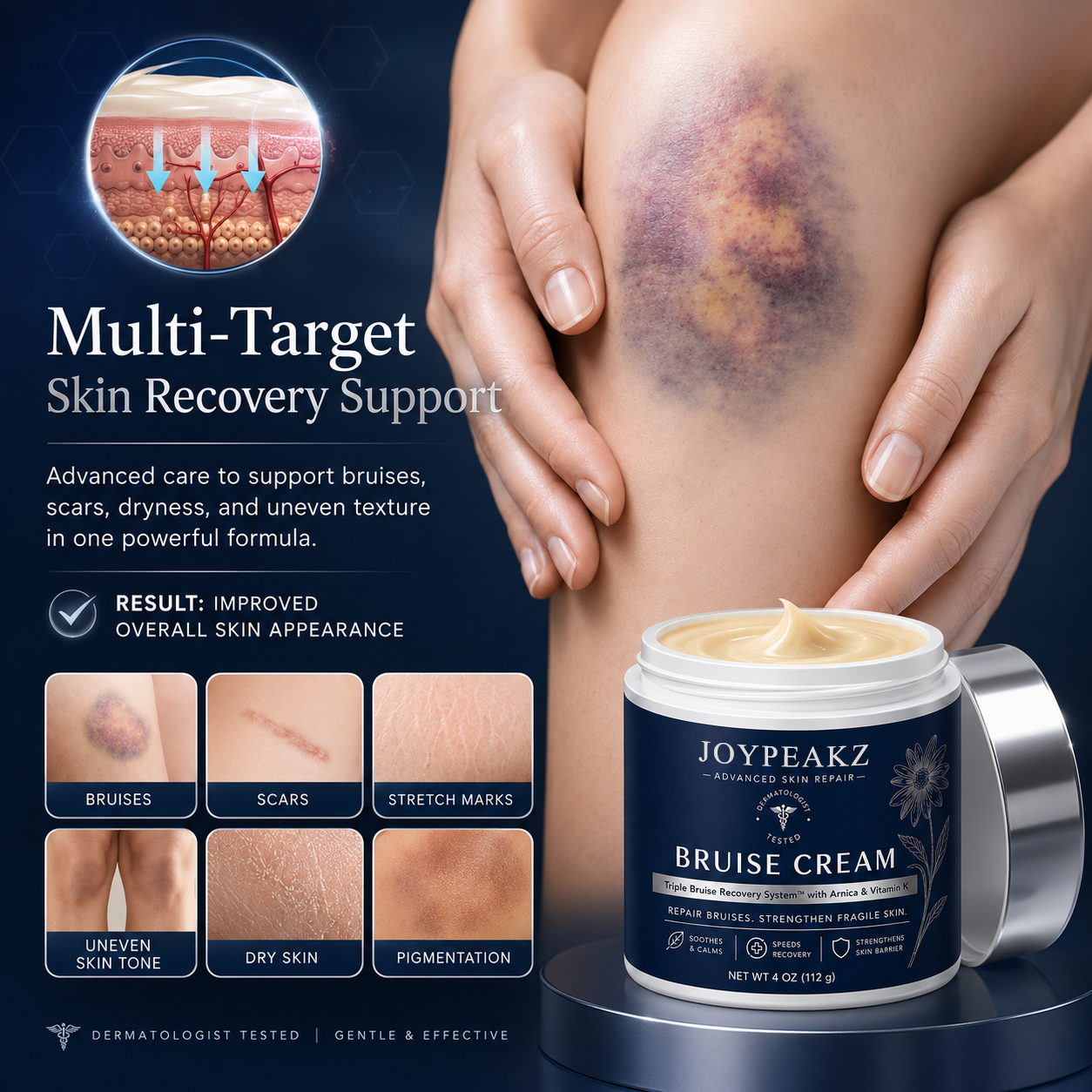 💥100K+ SOLD💕- Joypeakz™ Bruise Repair & Skin-Strengthening Cream