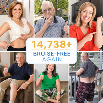 🔥100K+ Customers Served – JoyPeakz® Arnica Bruise Cream